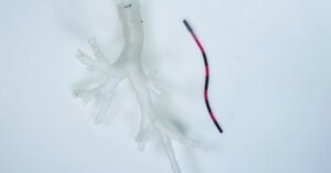 Read more about the article These tiny robotic tentacles could travel into the lungs to treat cancer
<span class="bsf-rt-reading-time"><span class="bsf-rt-display-label" prefix=""></span> <span class="bsf-rt-display-time" reading_time="2"></span> <span class="bsf-rt-display-postfix" postfix="min read"></span></span><!-- .bsf-rt-reading-time -->