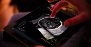 Read more about the article Samsung completes €86M takeover of French AI ultrasound startup Sonio